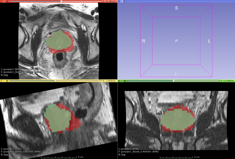 File:Prostate segmentation.png