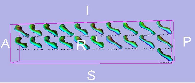 File:ShapeAnalysisModule theta mrml.jpg